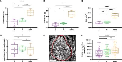 Glucose-Stimulated Calcium Dynamics in Beta Cells From Male C57BL/6J, C57BL/6N, and NMRI Mice: A Comparison of Activation, Activity, and Deactivation Properties in Tissue Slices